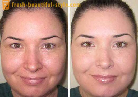 O toner para o rosto - o que é, e como usá-lo? Skin Care Products Rosto
