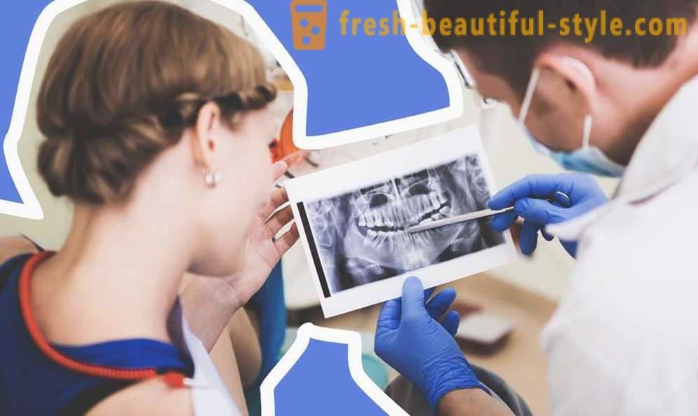 4 perguntas sobre implantes dentários