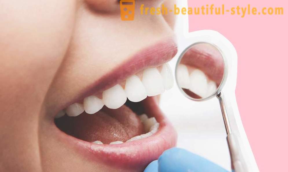 4 perguntas sobre implantes dentários
