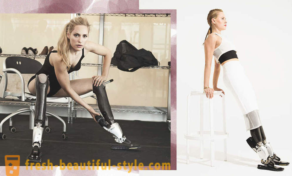 Beleza infinita: 6 modelos do sexo feminino com próteses