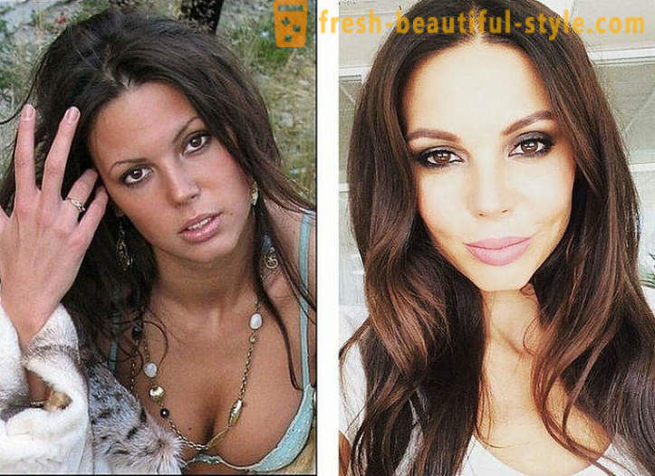 10 belezas russo antes e depois de plástico