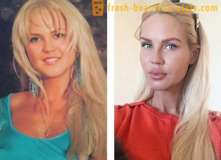 10 belezas russo antes e depois de plástico