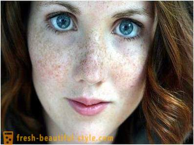Cuidar da sua beleza e juventude: provoca a pigmentação na face