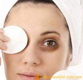 Conselhos sobre como remover os círculos escuros sob os olhos